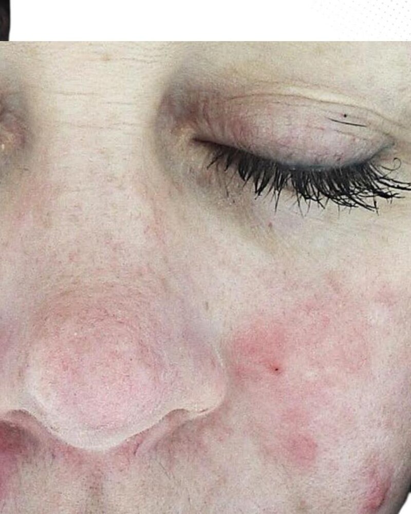 Close-up · Policzek